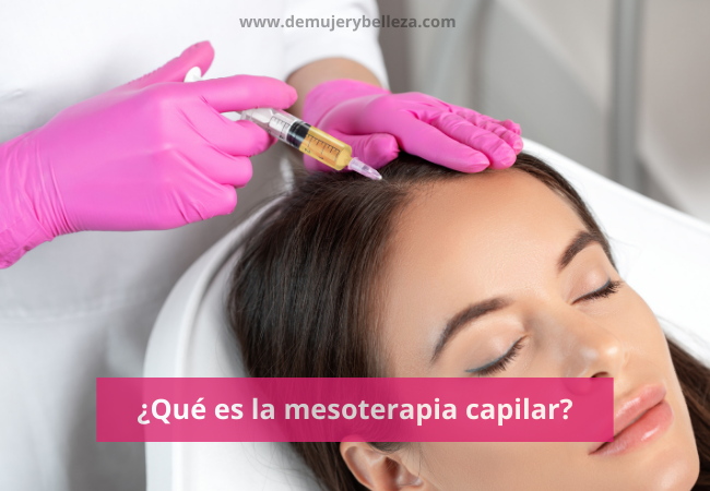 Mesoterapia capilar